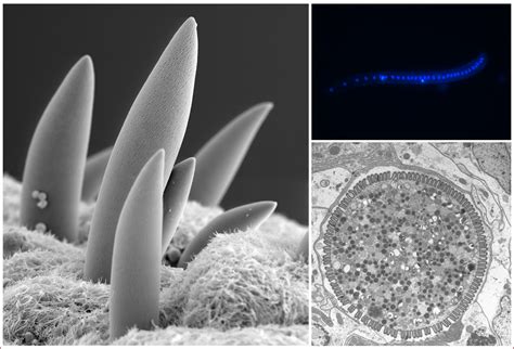  Johnstonella! A Glimpse into the Microscopic World of these Parasitic Sporozoans