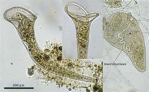  Stentor - Unveiling the Secrets of this Trumpet-Shaped Protist Living an Immobilized Existence!