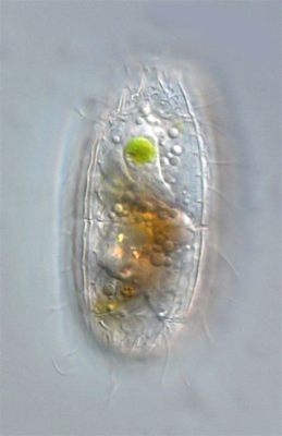  Coleps! An Exquisite Ciliate Whose Microscopic Body Exhibits the Wonders of Nature's Engineering