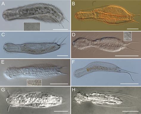 Gastrotrichs an Intriguing Freshwater Marvel: These Tiny Creatures Exhibit Remarkable Regenerative Abilities While Navigating Their Microscopic World!