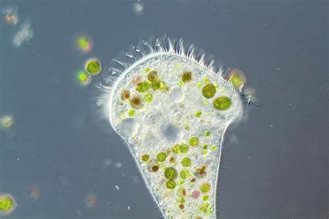  Stentor, an Enchanting Ciliate with Tentacle-Like Protrusions and Remarkable Regeneration Abilities!