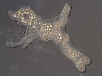  Tubulinea: This Unassuming Amoeba Holds Secrets to Cellular Architecture!